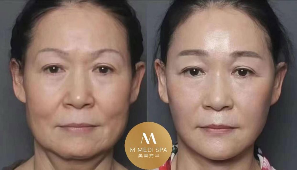 Toronto mmedispa