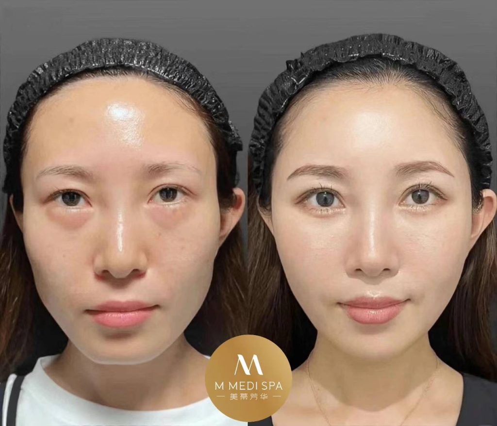 Toronto mmedispa