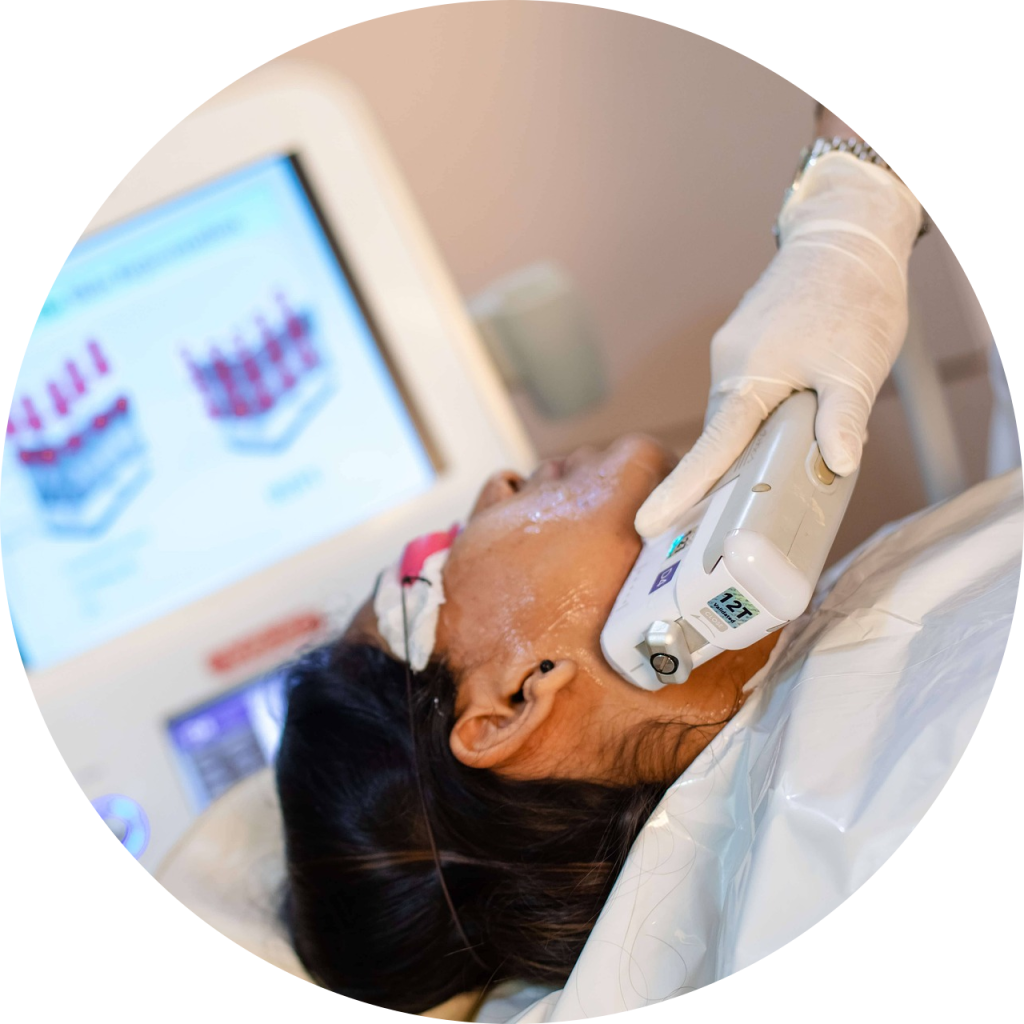 激光脱毛 多伦多