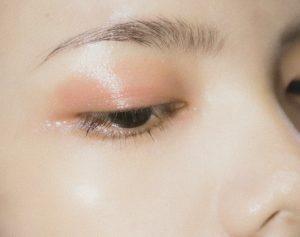 痘肌