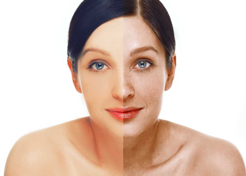 Wrinkle Treatment Toronto