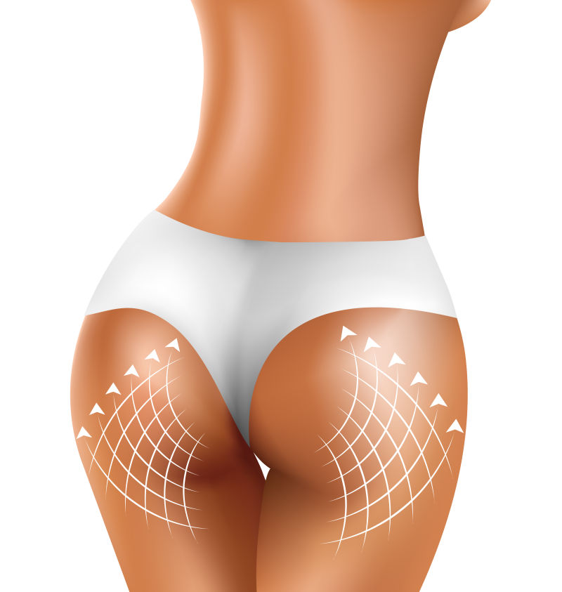 flat bum
