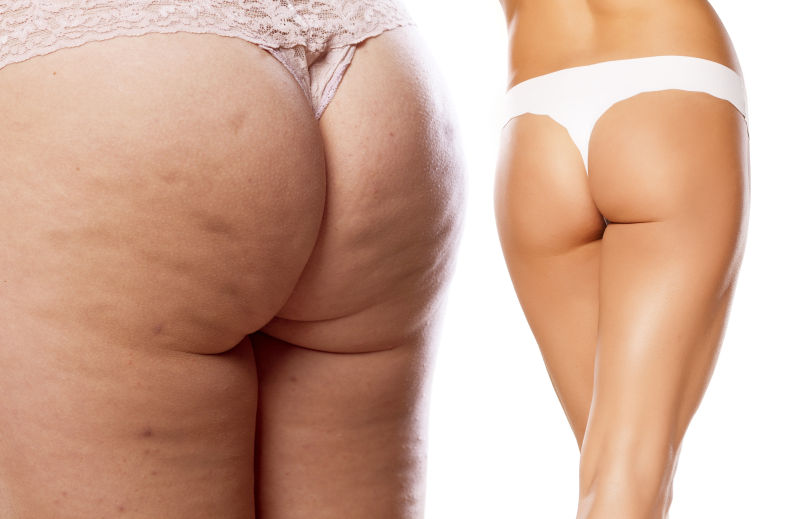 does walking tone your butt