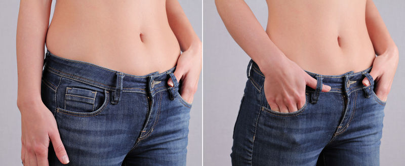 InMode 2025: Why Mississauga Women Choose Emsculpt for Abs & Butt | M Medi Spa