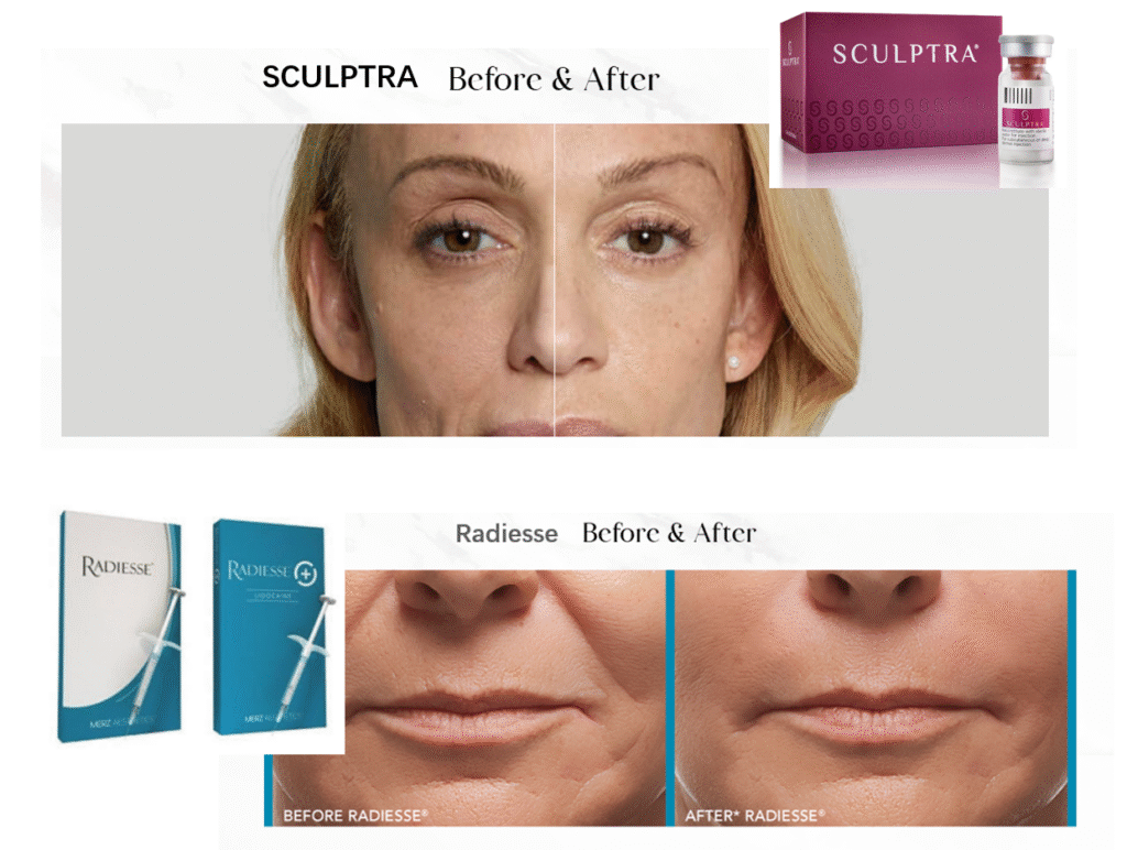 Radiesse vs Sculptra