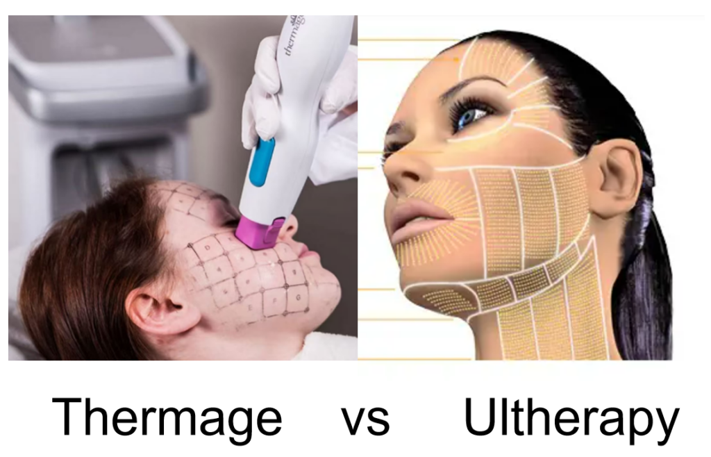 Thermage vs Ultherapy